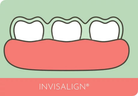 Invisalign